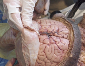 B3: Brain Tissue, Nuclei, Fluid & Peripheral Nervous System